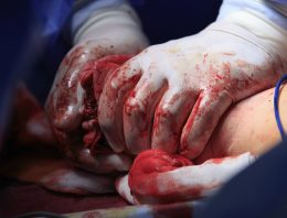 The Truth About Wound Care